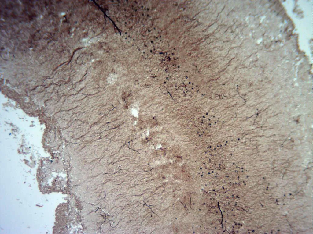 Microscopía de Stemonitopsis typhina - 12 -  KOH x 40